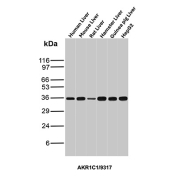 AKR1C1 Antibody Multi-Species Liver WB. Western blot analysis of (1) human liver, (2) mouse liver, (3) rat liver, (4) hamster liver, (5) guinea pig liver, and (6) HepG2 cell lysates using AKR1C1 Antibody (clone AKR1C1/9317) detects a band at approximately 37 kDa, consistent with the predicted molecular weight of AKR1C1 / Aldo-keto reductase family 1 member C1. The consistent banding pattern across species and hepatic cell models supports reliable detection of AKR1C1, aligning with its established role in steroid metabolism and detoxification pathways.