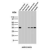 AKR1C1 Antibody Differential Species Reactivity Liver WB. Western blot analysis of (1) human liver, (2) mouse liver, (3) rat liver, (4) hamster liver, (5) guinea pig liver, and (6) HepG2 cell lysates using AKR1C1 Antibody (clone AKR1C1/9319) detects a band at approximately 37 kDa in human, hamster, guinea pig, and HepG2 samples, consistent with the predicted molecular weight of AKR1C1 / Aldo-keto reductase family 1 member C1. Signal is reduced or absent in mouse and rat samples, indicating species-dependent reactivity. This pattern supports selective detection of AKR1C1 and highlights differences in cross-species recognition for this clone.