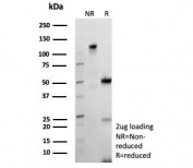 SDS-PAGE analysis of purified, BSA-free recombinant Bcl-X antibody (clone BCL2L1/9221R) as confirmation of integrity and purity.
