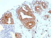 IHC staining of FFPE human prostate tissue with CD161 antibody (clone KLRB1/8910). Inset: PBS used in place of primary Ab (secondary Ab negative control). HIER: boil tissue sections in pH 9 10mM Tris with 1mM EDTA for 20 min and allow to cool before testing.