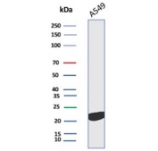 Western blot testing of human A549 cell lysate with Interleukin 18 antibody. Predicted molecular weight ~22 kDa.