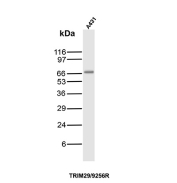TRIM29 Antibody A431 WB. Western blot analysis of A431 cell lysate using recombinant rabbit monoclonal clone TRIM29/9256R demonstrates a distinct band at approximately 65-70 kDa, consistent with the predicted molecular weight of Tripartite motif-containing protein 29 / TRIM29. The observed signal supports expression of this epithelial-associated TRIM family regulatory protein in squamous carcinoma-derived cells and aligns with the known association of TRIM29 with epithelial differentiation and carcinoma-related signaling pathways.