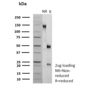 SDS-PAGE analysis of purified, BSA-free recombinant Tripartite motif-containing protein 29 antibody (clone TRIM29/9257R) as confirmation of integrity and purity.
