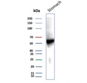 Western blot testing of human stomach tissue lysate with recombinant Carbonic Anhydrase IX antibody. Predicted molecular weight: 50-55 kDa but may be observed at higher molecular weights due to glycosylation.
