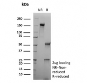 SDS-PAGE analysis of purified, BSA-free recombinant Carbonic Anhydrase IX antibody (clone CA9/9621R) as confirmation of integrity and purity.