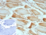 IHC staining of FFPE human skeletal muscle tissue with ZNF408A antibody (clone ZNF804A/8945). Inset: PBS used in place of primary Ab (secondary Ab negative control). HIER: boil tissue sections in pH 9 10mM Tris with 1mM EDTA for 20 min and allow to cool before testing.