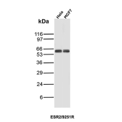 Estrogen Receptor beta 1 Antibody HeLa and MCF7 WB. Western blot analysis of human HeLa and MCF7 cell lysates using Estrogen Receptor beta 1 antibody (clone ESR2/9251R) detects a band at approximately 55-60 kDa, consistent with the predicted molecular weight of Estrogen receptor beta (ESR2).