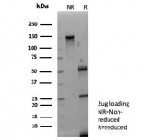 SDS-PAGE analysis of purified, BSA-free Fibroblast Growth Factor 23 antibody (clone FGF23/9059) as confirmation of integrity and purity.