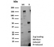 SDS-PAGE analysis of purified, BSA-free Fibroblast Growth Factor 23 antibody (clone FGF23/9060) as confirmation of integrity and purity.
