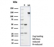 SDS-PAGE analysis of purified, BSA-free Resistin antibody (clone RETN/4325) as confirmation of integrity and purity.