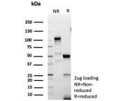 SDS-PAGE analysis of purified, BSA-free recombinant recombinant LEF1 antibody (clone LEF1/9403R) as confirmation of integrity and purity.