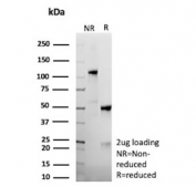SDS-PAGE analysis of purified, BSA-free recombinant Anaplastic Lymphoma Kinase antibody (clone ALK1/9660R) as confirmation of integrity and purity.