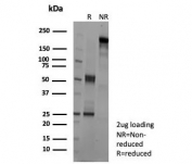 SDS-PAGE analysis of purified, BSA-free Kallikrein 4 antibody (clone KLK4/8942) as confirmation of integrity and purity.
