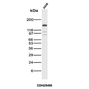 Cadherin 2 Antibody WB. Western blot analysis of N-Cadherin / CDH2 expression in A549 cell lysate using Cadherin 2 antibody clone CDH2/9490. Lane 1: A549 cell lysate. A prominent band is detected at approximately 120-135 kDa, consistent with the predicted molecular weight of N-Cadherin (CDH2), with the higher apparent migration reflecting known glycosylation of this transmembrane adhesion protein. Additional faint lower bands may represent proteolytic fragments or partially processed forms. The observed expression in A549 cells is consistent with N-Cadherin involvement in epithelial-to-mesenchymal transition and tumor-associated cellular remodeling.