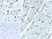 Cadherin 2 Antibody Heart Tissue IHC. Immunohistochemical analysis of N-Cadherin / CDH2 expression in formalin-fixed, paraffin-embedded human heart tissue using Cadherin 2 antibody clone CDH2/9491. Predominantly membranous staining is observed along cardiomyocyte cell-cell junctions, with additional cytoplasmic signal in cardiac muscle fibers, consistent with localization at intercalated discs. The staining pattern highlights the structural role of N-Cadherin in maintaining cardiac tissue integrity. The inset shows a negative control with PBS used in place of the primary antibody, confirming minimal non-specific background. HIER: boil tissue sections in pH 9 10mM Tris with 1mM EDTA for 20 min and allow to cool before testing.