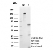 SDS-PAGE analysis of purified, BSA-free CDH2 antibody (clone CDH2/9492) as confirmation of integrity and purity.