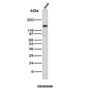 Cadherin 2 Antibody A549 Cell Lysate WB. Western blot analysis of N-Cadherin / CDH2 expression in A549 cell lysate using Cadherin 2 antibody clone CDH2/9494. Lane 1: A549 cell lysate. A clear band is detected at approximately 120-135 kDa, consistent with the predicted molecular weight of N-Cadherin (CDH2), with the higher apparent migration reflecting known glycosylation of this transmembrane adhesion protein. Faint lower bands are also present and may represent proteolytic fragments or partially processed forms. The detection pattern in A549 cells is consistent with reported N-Cadherin expression in epithelial-derived cancer cell lines undergoing epithelial-to-mesenchymal transition.