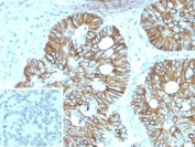 IHC staining of FFPE human colon tissue with LI-Cadherin antibody (clone CDH17/2614). Inset: PBS used in place of primary Ab (secondary Ab negative control). HIER: boil tissue sections in pH 9 10mM Tris with 1mM EDTA for 20 min and allow to cool before testing.