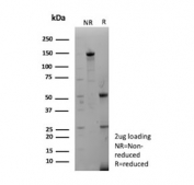 SDS-PAGE analysis of purified, BSA-free Mesothelin antibody (clone MSLN/2132) as confirmation of integrity and purity.