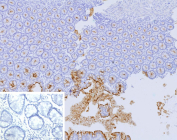 CEA Antibody Human Colon Tissue IHC. Immunohistochemistry staining of FFPE human colon tissue with CEA antibody (clone CEACAM5/12673). Inset: PBS used in place of primary Ab (secondary Ab negative control). HIER: boil tissue sections in pH 9 10mM Tris with 1mM EDTA for 20 min and allow to cool before testing.
