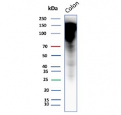Western blot testing of human colon tissue with CEA antibody (clone CEACAM5/12673). Predicted molecular weight ~77 kDa but may be observed at higher molecular weights due to glycosylation.