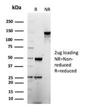 SDS-PAGE analysis of purified, BSA-free CEA antibody (CEACAM5/12673) as confirmation of integrity and purity.