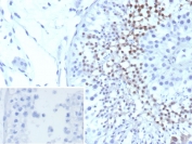IHC staining of FFPE human testis tissue with Centrin 1 antibody (clone CETN1/9880). Inset: PBS used in place of primary Ab (secondary Ab negative control). HIER: boil tissue sections in pH 9 10mM Tris with 1mM EDTA for 20 min and allow to cool before testing.