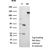 SDS-PAGE analysis of purified, BSA-free CEN1 antibody (clone CETN1/9877) as confirmation of integrity and purity.