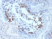 IHC staining of FFPE human testis tissue with CEN1 antibody (clone CETN1/9877). Inset: PBS used in place of primary Ab (secondary Ab negative control). HIER: boil tissue sections in pH 9 10mM Tris with 1mM EDTA for 20 min and allow to cool before testing.