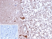 IHC staining of FFPE human cerebellum tissue with Creatine kinase B-type antibody (clone CKBB/6636). Inset: PBS used in place of primary Ab (secondary Ab negative control). HIER: boil tissue sections in pH 9 10mM Tris with 1mM EDTA for 20 min and allow to cool before testing.