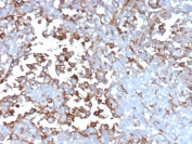 IHC staining of FFPE human adrenal gland tissue with Clusterin antibody (clone CLU/12059). HIER: boil tissue sections in pH 9 10mM Tris with 1mM EDTA for 20 min and allow to cool before testing.