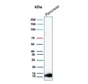 Western blot testing of human pancreas tissue lysate with CLPS antibody. Predicted molecular weight ~12 kDa.