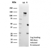SDS-PAGE analysis of purified, BSA-free CPS1 antibody (clone CPS1/9857) as confirmation of integrity and purity.
