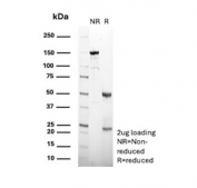 SDS-PAGE analysis of purified, BSA-free Carbamoyl phosphate synthetase 1 antibody (clone CPS1/9867) as confirmation of integrity and purity.