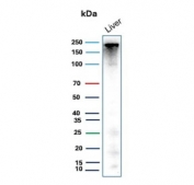 Western blot testing of human liver lysate with Carbamoyl phosphate synthetase 1 antibody (clone CPS1/9867). Predicted molecular weight ~165 kDa but may be observed at higher molecular weights due to glycosylation.