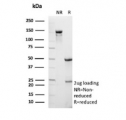 SDS-PAGE analysis of purified, BSA-free CPSase I antibody (clone CPS1/9869) as confirmation of integrity and purity.