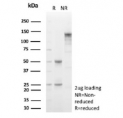 SDS-PAGE analysis of purified, BSA-free Decorin antibody (clone DCN/3521) as confirmation of integrity and purity.
