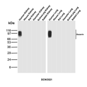 Decorin Antibody Multi-Species Kidney and Lung WB. Western blot analysis of kidney and lung tissue lysates from human, mouse, rat, hamster, guinea pig, and rabbit using Decorin Antibody (clone DCN/3521) detects bands at approximately 90-120 kDa, consistent with glycosylated forms of Decorin (DCN). The observed variation in band intensity and migration reflects species-specific differences in glycosaminoglycan modification and glycosylation state of this extracellular matrix proteoglycan. The conserved detection across multiple species supports reliable recognition of DCN and its post-translationally modified forms.