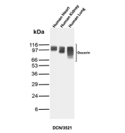 Decorin Antibody Human Tissue Panel WB. Western blot analysis of human 1) heart, 2) kidney, and 3) lung tissue lysates using Decorin Antibody (clone DCN/3521) detects bands at approximately 90-120 kDa, consistent with glycosylated forms of Decorin (DCN). Decorin is a secreted extracellular matrix proteoglycan, and its migration at higher apparent molecular weights reflects glycosaminoglycan modification and variable glycosylation states across tissues. The banding pattern across multiple tissues supports reliable detection of DCN and its post-translationally modified forms.