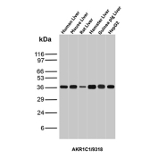 AKR1C1 Antibody Multi-Species Liver WB. Western blot analysis of (1) human liver, (2) mouse liver, (3) rat liver, (4) hamster liver, (5) guinea pig liver, and (6) HepG2 cell lysates using AKR1C1 Antibody (clone AKR1C1/9318) detects a band at approximately 37 kDa, consistent with the predicted molecular weight of AKR1C1 / Dihydrodiol dehydrogenase 1. The uniform banding pattern across species and hepatic models supports reliable detection of this cytosolic detoxification enzyme, aligning with its role in xenobiotic metabolism and cellular stress response pathways.