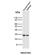 HBEGF Antibody Heart and PANC28 WB. Western blot analysis of human heart and PANC28 cell lysates using HBEGF antibody detecting Heparin-binding EGF-like growth factor (HB-EGF), clone HBEGF/9503. A band is detected at approximately 25-30 kDa in both samples, consistent with the predicted molecular weight of HBEGF, with size reflecting glycosylation and processing of the membrane-associated precursor (proHB-EGF). This pattern aligns with the biology of HBEGF as a heparin-binding EGFR ligand that undergoes regulated shedding to generate soluble signaling forms in both normal tissue and carcinoma-derived cells.