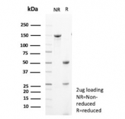 SDS-PAGE analysis of purified, BSA-free recombinant HER-2 antibody (clone ERBB2/13055R) as confirmation of integrity and purity.