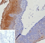 IHC staining of FFPE human tonsil tissue with Tissue Factor antibody (clone CD142/9195). Inset: PBS used in place of primary Ab (secondary Ab negative control). HIER: boil tissue sections in pH 9 10mM Tris with 1mM EDTA for 20 min and allow to cool before testing.