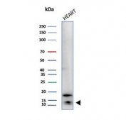 Western blot testing of human heart tissue lysate with H-FABP antibody (clone FABP3/3770). Predicted molecular weight ~14 kDa.