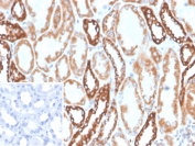 IHC staining of FFPE human kidney tissue with Phospholipase A2 receptor 1 antibody (clone PLA2R1/4894). Inset: PBS used in place of primary Ab (secondary Ab negative control). HIER: boil tissue sections in pH 9 10mM Tris with 1mM EDTA for 20 min and allow to cool before testing.