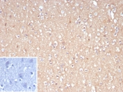IHC staining of FFPE human brain tissue with FOXO1 antibody (clone FOXO1/9792). Inset: PBS used in place of primary Ab (secondary Ab negative control). HIER: boil tissue sections in pH 9 10mM Tris with 1mM EDTA for 20 min and allow to cool before testing.