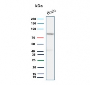Western blot testing of human brain tissue lysate with FOXO1 antibody (clone FOXO1/9792). Predicted molecular weight ~70 kDa.