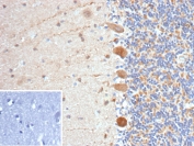 IHC staining of FFPE human brain tissue with FLT3 antibody (clone FLT3/9883). Inset: PBS used in place of primary Ab (secondary Ab negative control). HIER: boil tissue sections in pH 9 10mM Tris with 1mM EDTA for 20 min and allow to cool before testing.