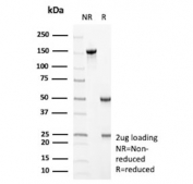 SDS-PAGE analysis of purified, BSA-free Fms-like tyrosine kinase 3 antibody (clone FLT3/9886) as confirmation of integrity and purity.