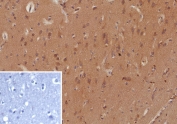 IHC staining of FFPE human brain tissue with Fms-like tyrosine kinase 3 antibody (clone FLT3/9887). Inset: PBS used in place of primary Ab (secondary Ab negative control). HIER: boil tissue sections in pH 9 10mM Tris with 1mM EDTA for 20 min and allow to cool before testing.